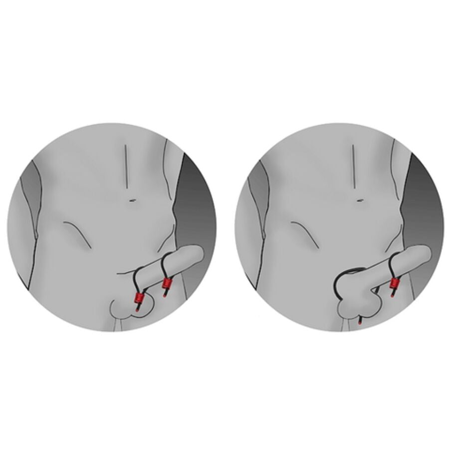 ELECTRASTIM - PRESTIGE ELECTRA LOOPS ADJUSTABLE COCK RINGS RED